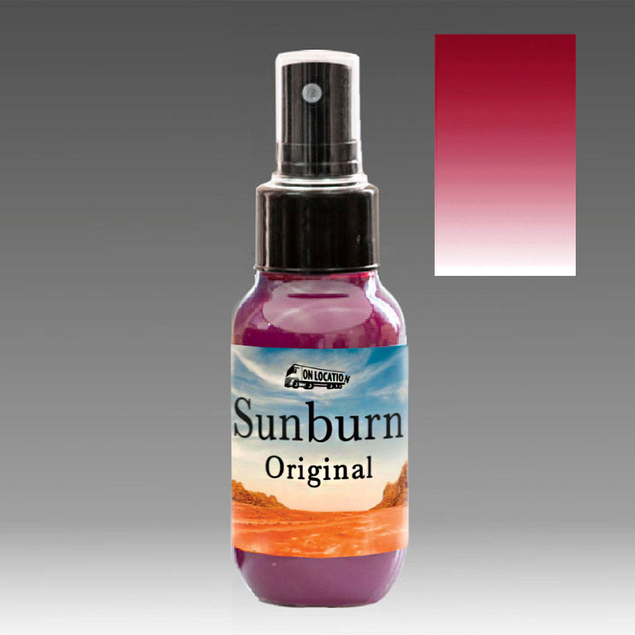Sunburn