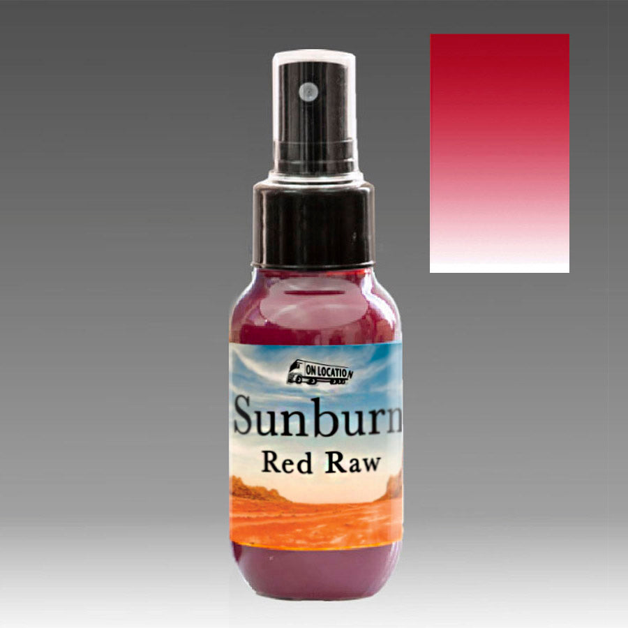 Sunburn