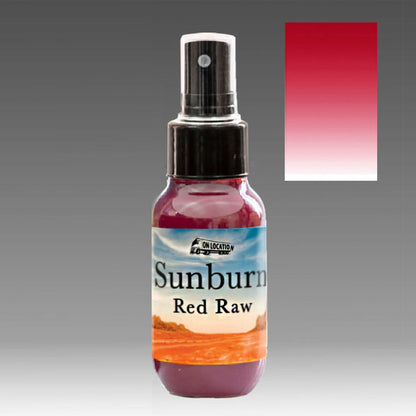 Sunburn